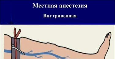 Анестезия и наркоз: Как они работают и стоит ли их бояться Что такое местная анестезия в хирургии